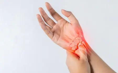 Rheumatoid Arthritis vs. Osteoarthritis: Understanding the Key Differences