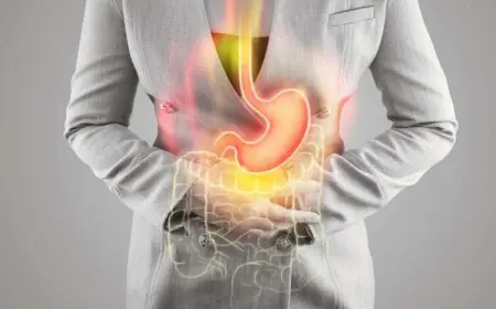 Understanding the Link Between Gastric Ulcers and Stomach Cancer Risk