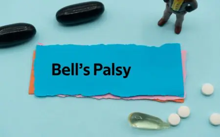 Understanding Bell’s Palsy: Causes, Prevalence and Risk Factors
