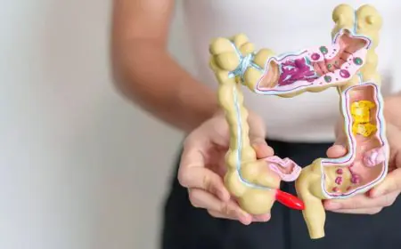 Researchers Develop Blood Test With High Accuracy For Detecting Colon Cancer