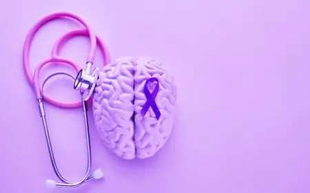 The Stigma of Seizure: How Language Can Impact People with Epilepsy