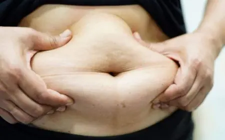 The Heavy Toll Of Obesity - Why India Needs An Immediate Action? Expert Weigh