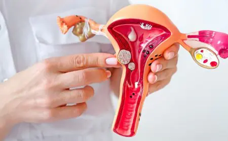 The Overlooked Link Between Endometriosis and Recurrent Miscarriage