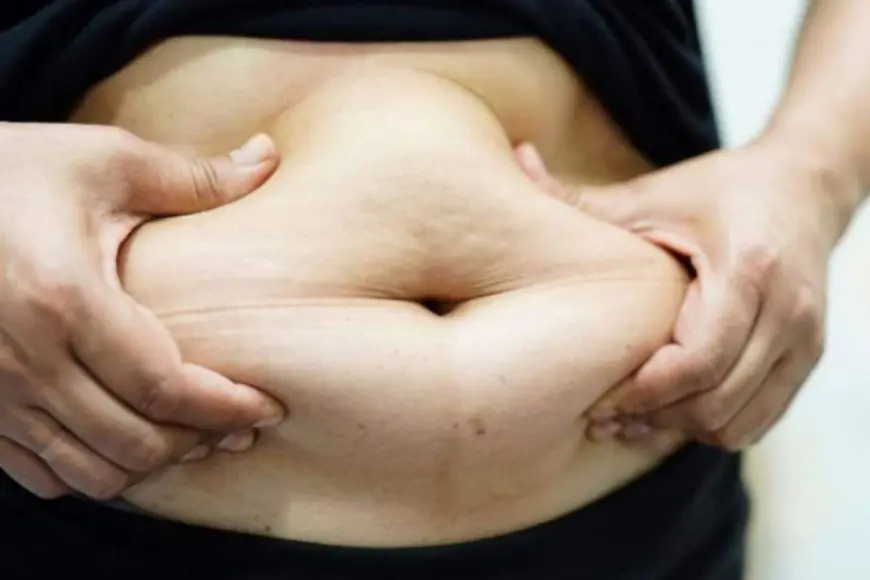 The Heavy Toll Of Obesity - Why India Needs An Immediate Action? Expert Weigh