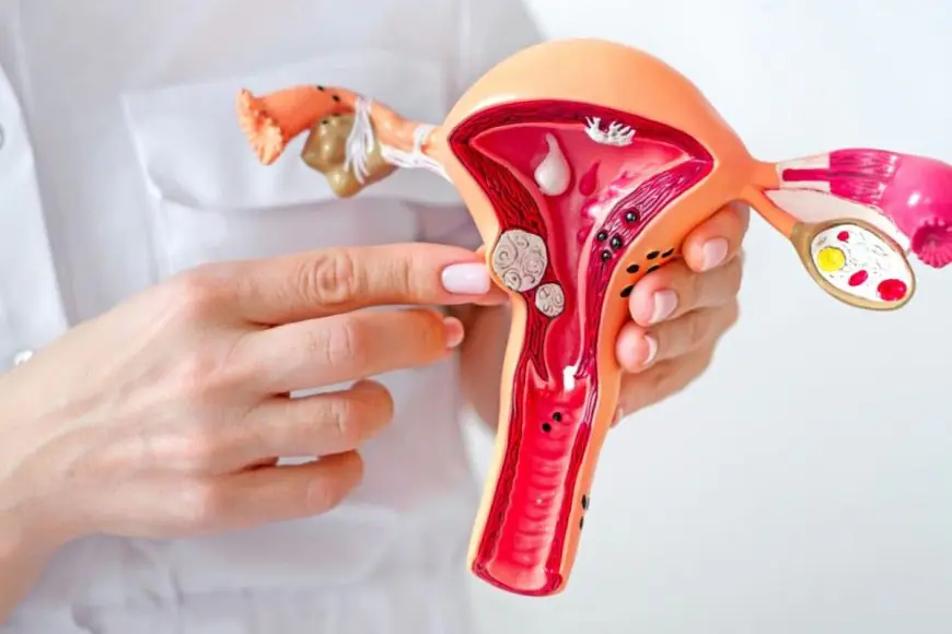 The Overlooked Link Between Endometriosis and Recurrent Miscarriage
