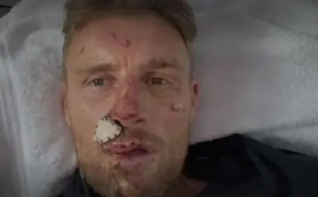 "Thought My Face Had Come Off, I Was Dead": England Great Recounts Horrific Car Crash