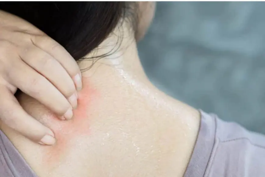 Why Heat Rashes Are on the Rise — and How to Protect Your Family This Summer