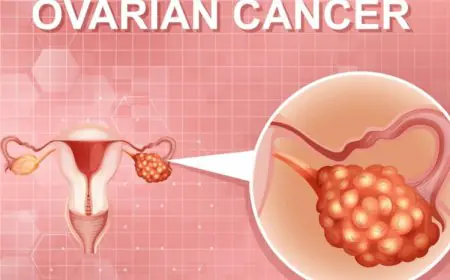 From Kitchen to Clinic: The Food Ovarian Cancer Connection