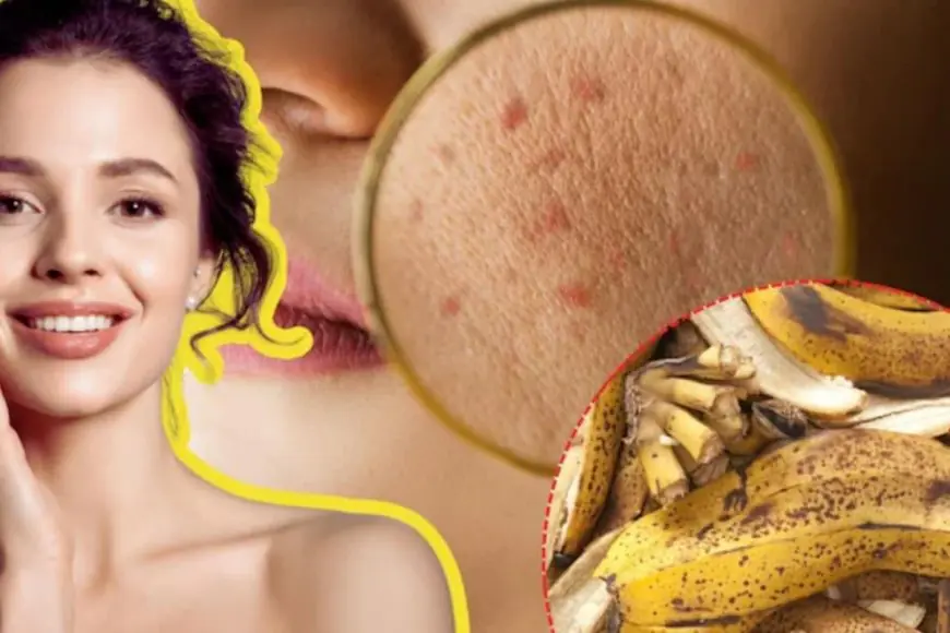 How To Use Banana Peel Directly On Your Face For Glowing Skin