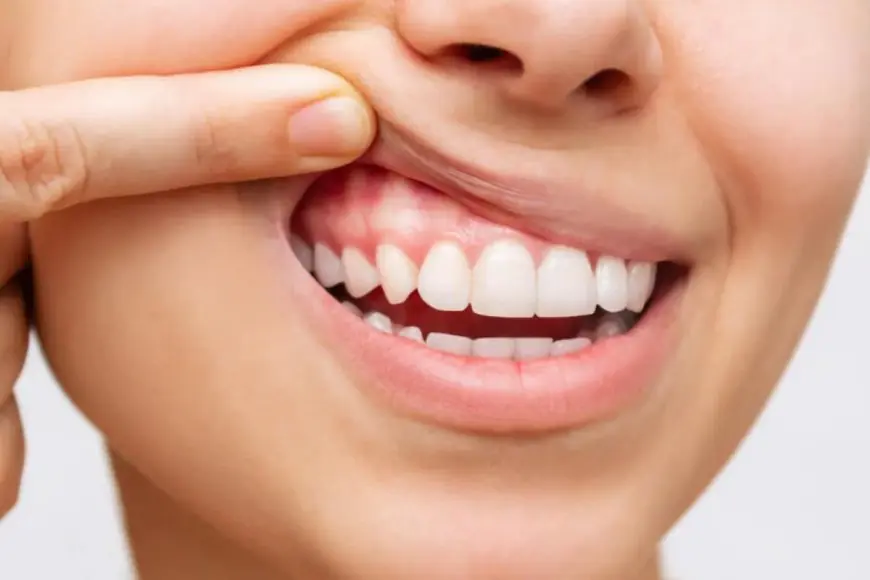 Let’s Talk Gums: The Unsung Heroes of Your Oral Health