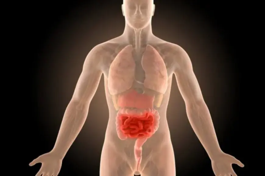 Crohn’s Disease: Understanding the Symptoms, Risks, and Insights