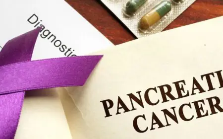 Pancreatic Cancer: Know The Four Stages, Early Symptoms, And How To Protect Yourself