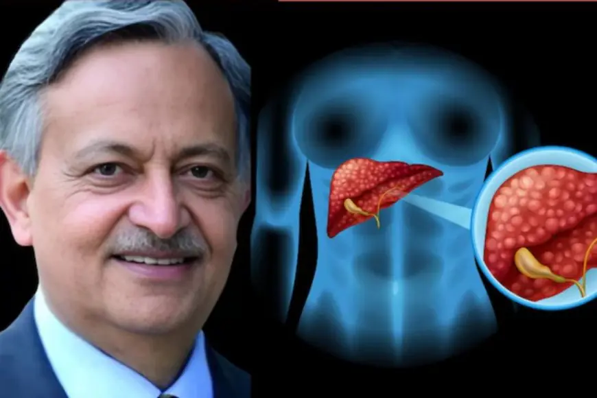 Fatty Liver Can Be Reversed: Top Doctor Shares Simple And Effective Tips
