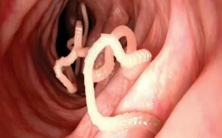 Tapeworms: 7 Vegetables That May Carry Brain-Eating Parasites