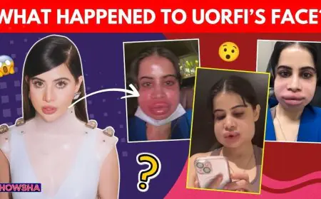 Uorfi Javed’s Swollen Face Sparks A Meme Fest But She Shares The Candid Truth Like A Pro