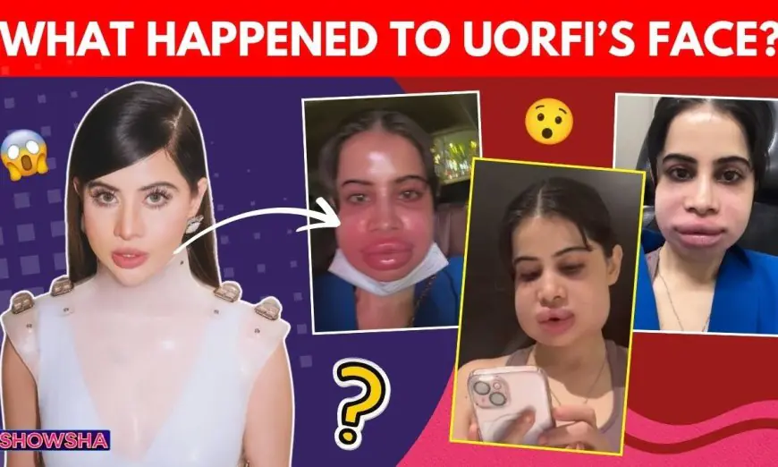 Uorfi Javed’s Swollen Face Sparks A Meme Fest But She Shares The Candid Truth Like A Pro