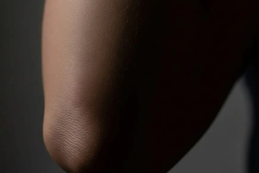 Here's How To Get Rid Of Dark Elbows And Knees With Kitchen Ingredients