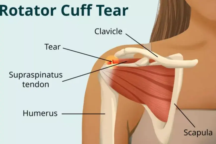 Are We Overlooking Simple Shoulder Injuries That Could Lead To Bigger Problems?