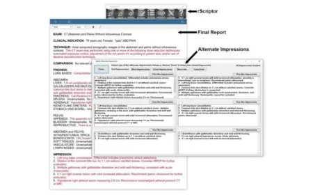 rScriptor Enhances Radiology Workflow With Flexible AI Impression Generation