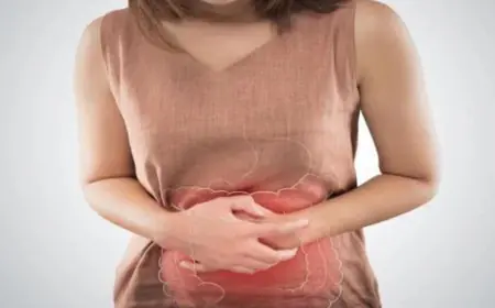Why Hernia Symptoms In Women Are Often Missed: Expert Explains The Hidden Signs And Risks
