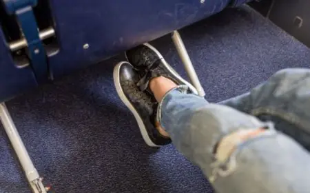 4 Expert-Approved Ways To Reduce Leg Swelling After Long Winter Flights
