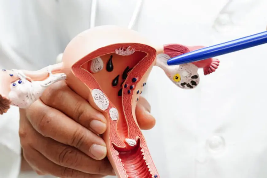 A Simple Test That Can Save Lives: What Every Woman Should Know About Cervical Cancer