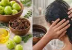 Grey Hair Before 30? Here's How You Can Use Amla To Get Darker, Stronger Hair