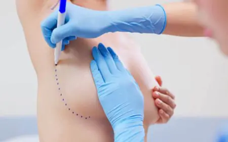 'I Wanted To Feel Like Myself Again As A Woman': How Breast Reconstruction Became A Turning Point After Cancer At 48