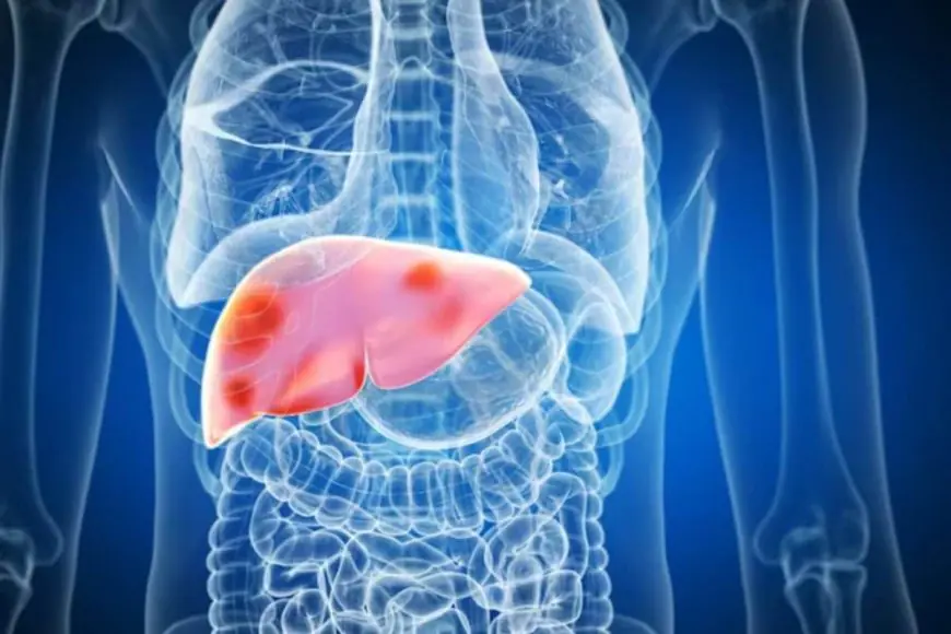 DYK Europeans Drink Alcohol Regularly Yet Have Lower Fatty Liver Rates Than Indian Teetotalers?