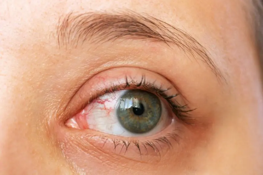 These Are 5 Common Myths About Blindness And Eye Health You Shouldn't Believe