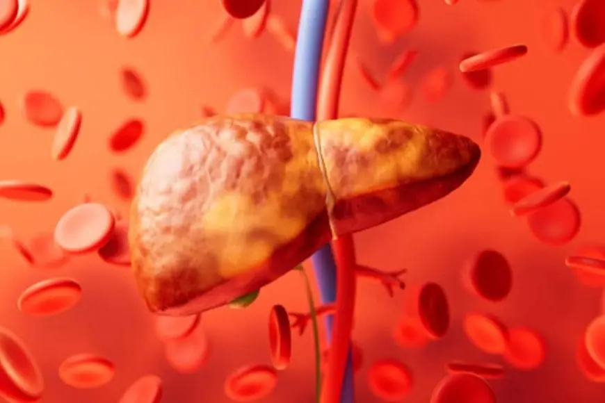 Liver Health Isn’t Defined By Alcohol: Growing Threat Of Liver Damage In Non-Drinkers